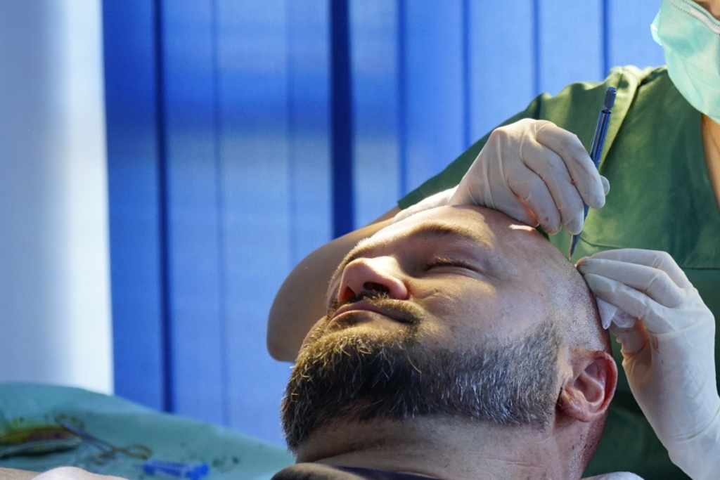 TRANSPLANTACIJA_KOSE_VATANMED-SARAJEVO