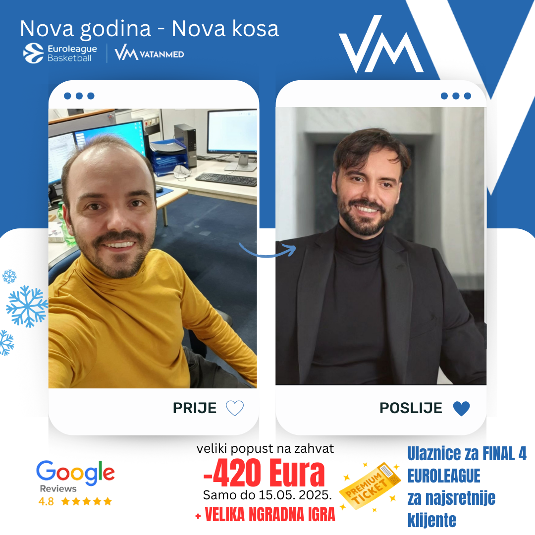 Rezultat transplantacije kose