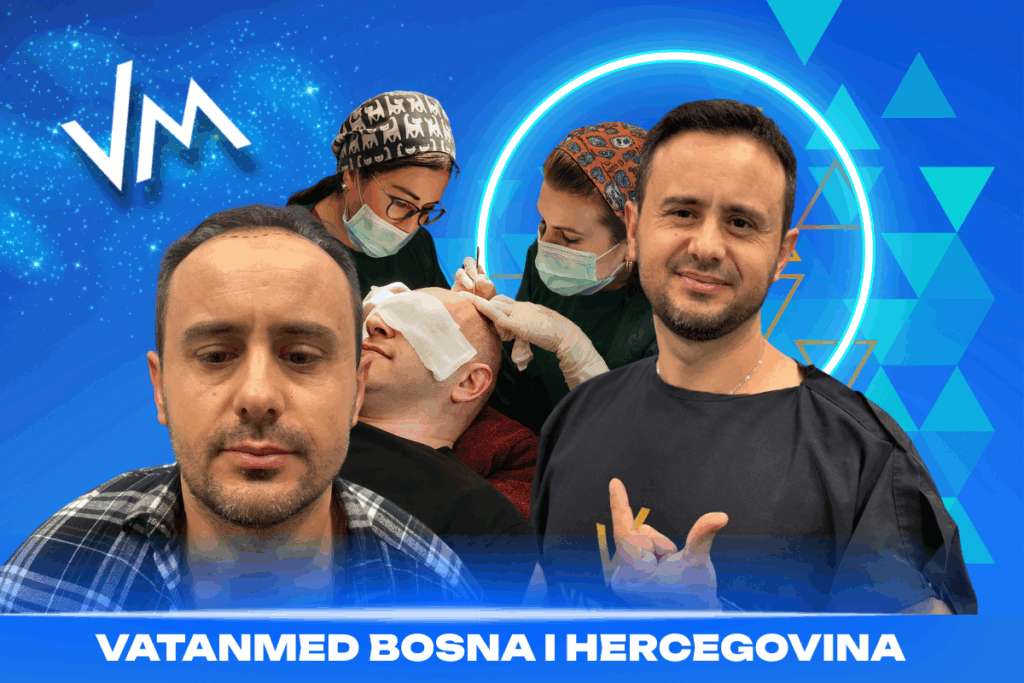 razlozi za transplantaciju kose