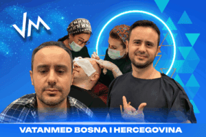 razlozi za transplantaciju kose