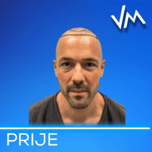 Pacijent 2 — prije