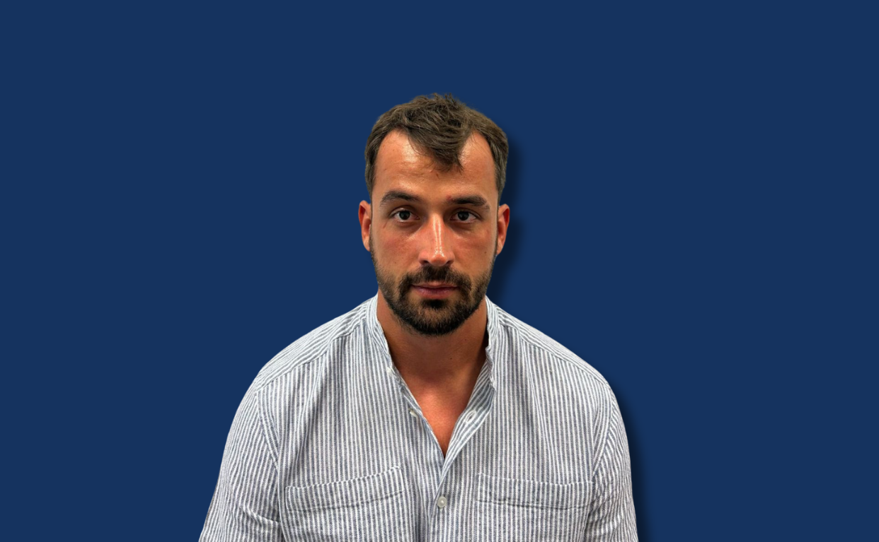 Prije transplantacije kose – VatanMed Sarajevo